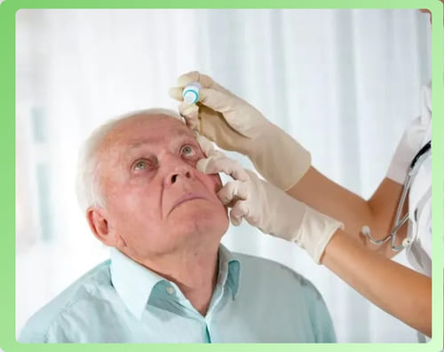 Sử dụng thuốc nhỏ mắt trị cườm nước