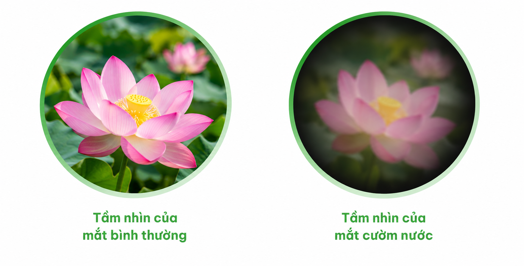Tầm nhìn cườm nước
