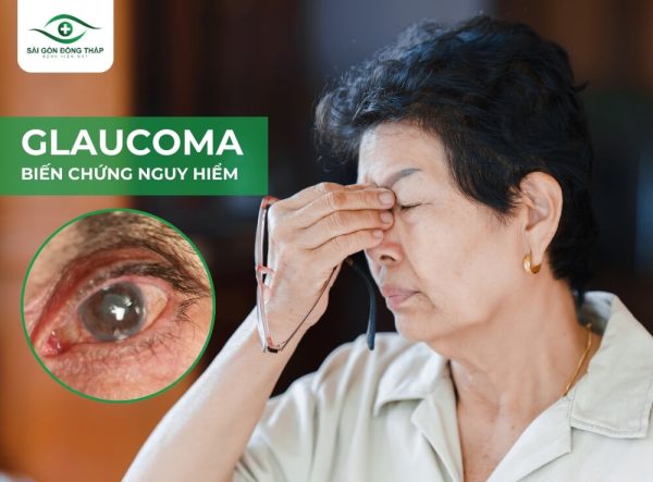 glaucoma-cuom-nuoc