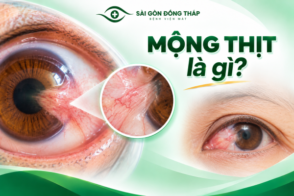 mong-thit-la-gi-may-thit