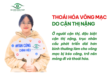 thoai-hoa-vong-mac-do-can-thi-nang