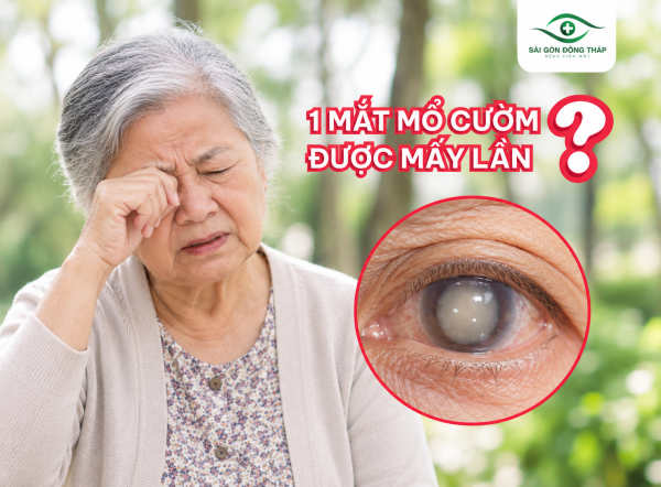 Mổ cườm 1 mắt được mấy lần? Tại sao mổ cườm xong mắt vẫn mờ