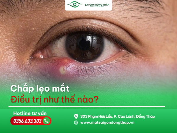 chắp lẹo mắt
