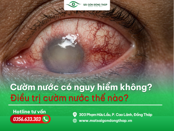 cườm nước có nguy hiểm không