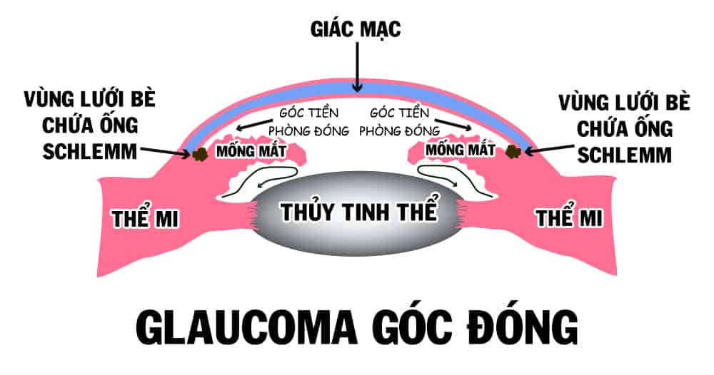 cuom-nuoc-goc-dong