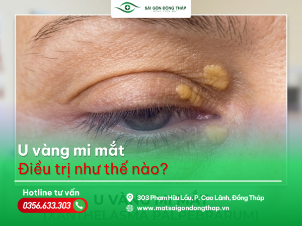 u-vang-mi-ma
