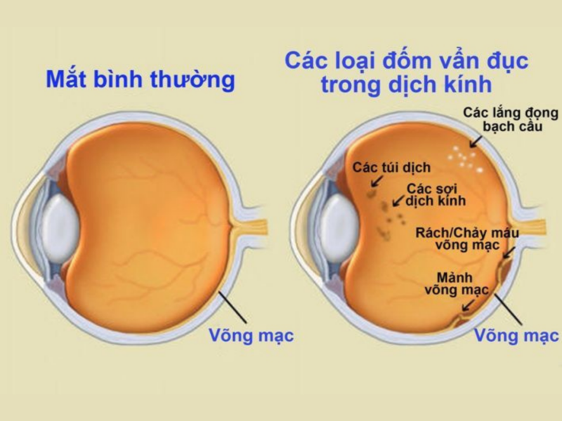 van-duc-dich-kinh