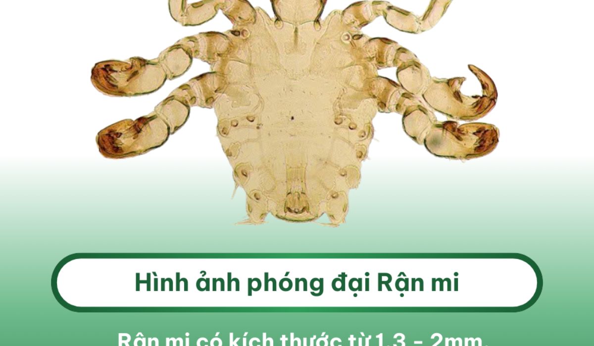 Rận mu khi được phóng đại với kích thước từ 1,3–2mm, có 6 chân và thân hình tròn dẹp