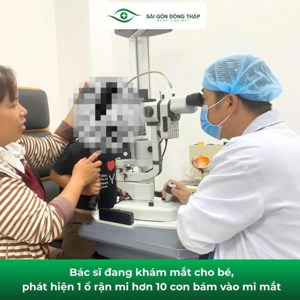 rận mi mắt