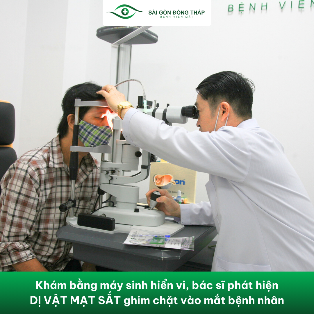 mạt sắt trong mắt