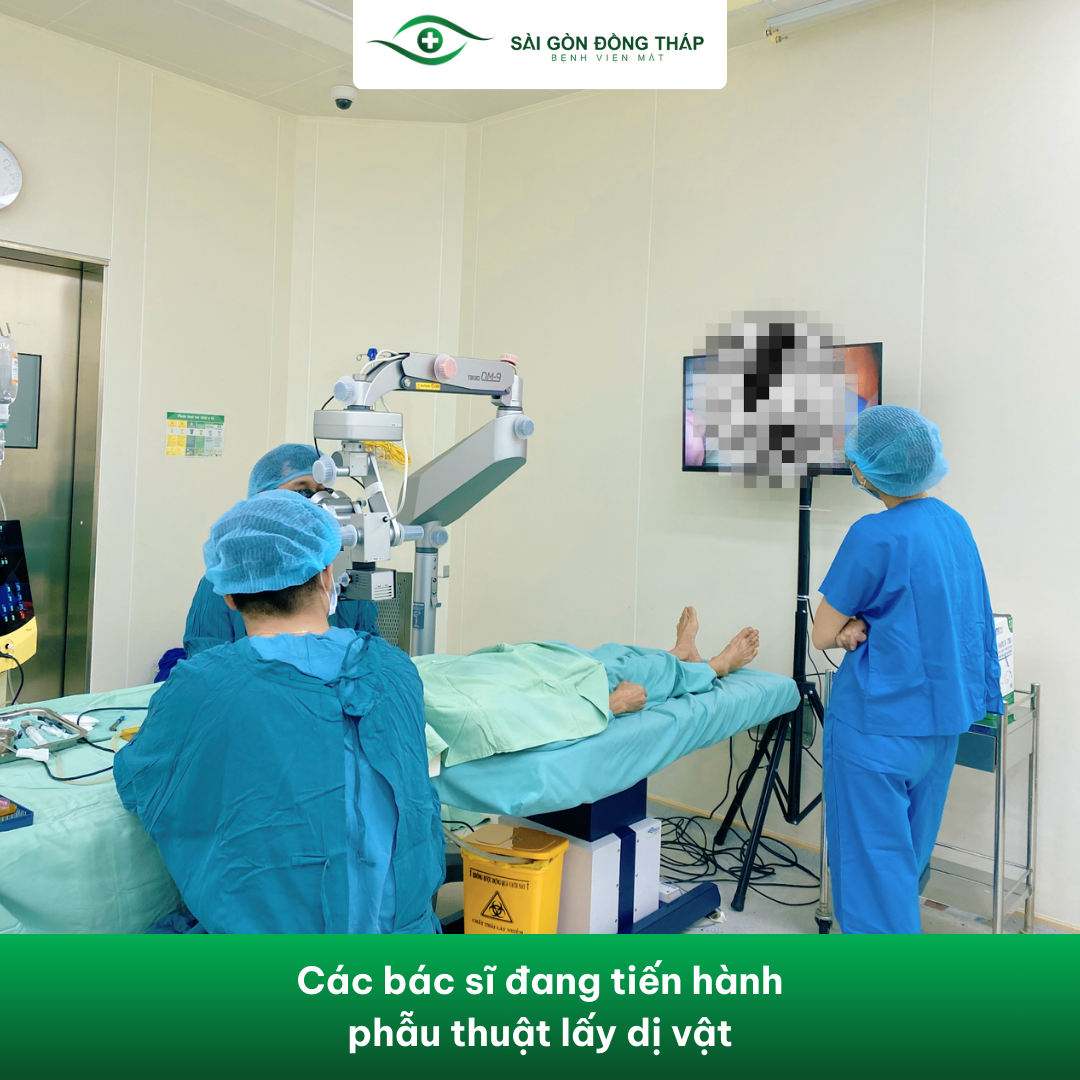 phẫu thuật lấy mạt sắt