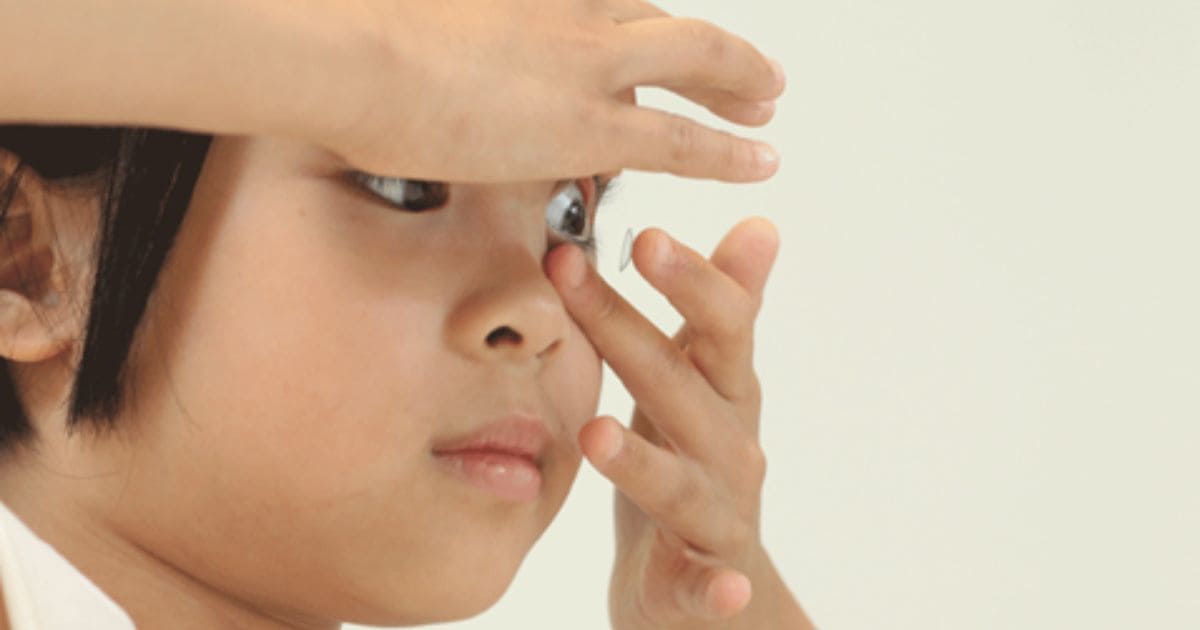 Em bé bị cận nên dùng kính áp tròng Ortho K