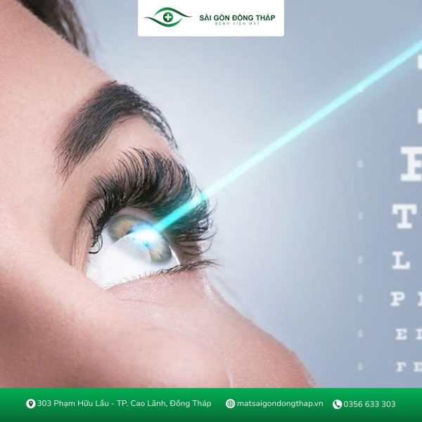 phẫu thuật khúc xạ mắt