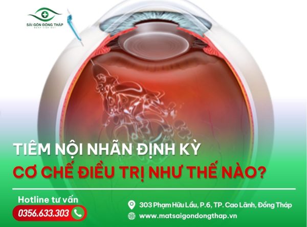 tiêm nội nhãn định kỳ và cơ chế điều trị